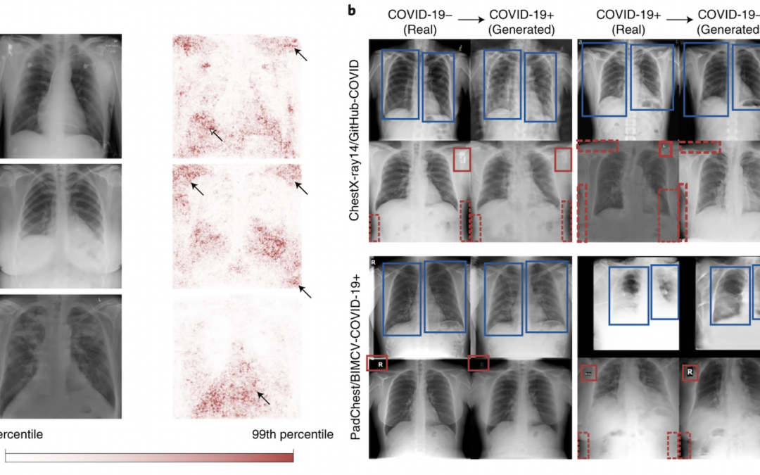 AI for radiographic COVID-19 detection selects shortcuts over signal